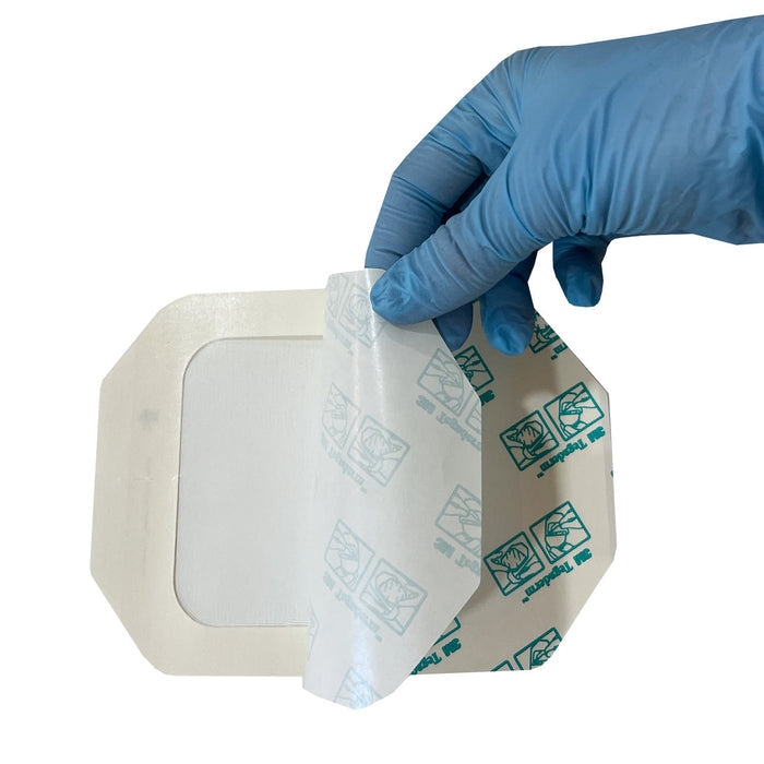 Transparent Film Dressing, peeled