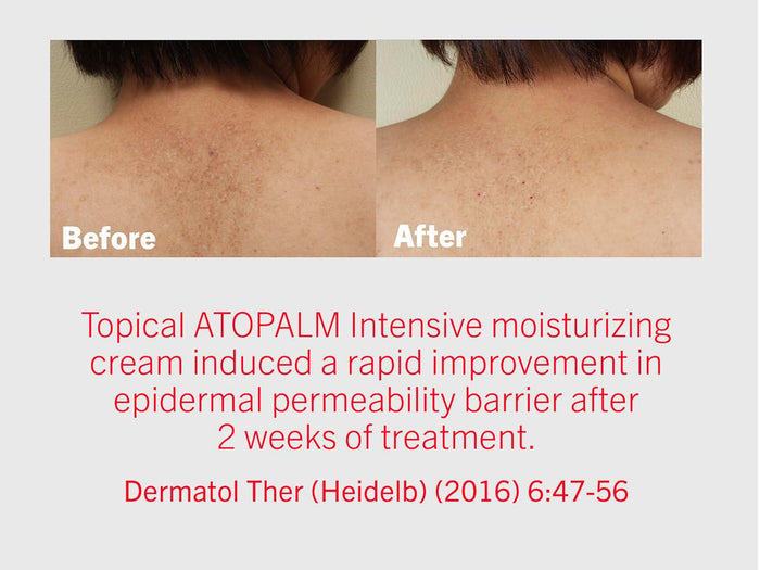 ATOPALM Mle Cream 100 mL