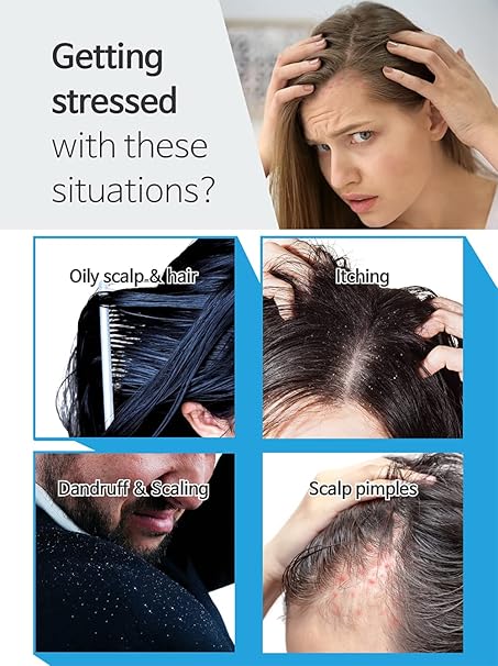 [ Ballvic ] Sebo Shampoo for Dandruff Treatment ( 17.6 oz )