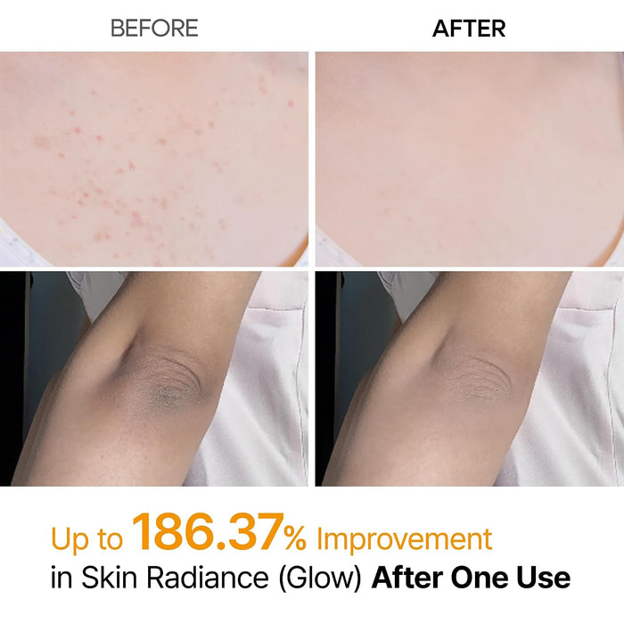 Dr. Melaxin Peel Shot Kojic Acid Turmeric Spray - 200ml