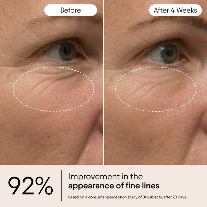 Alpyn Beauty-Line-Filling Eye Balm-Skincare-LineFilling4-The Detox Market |