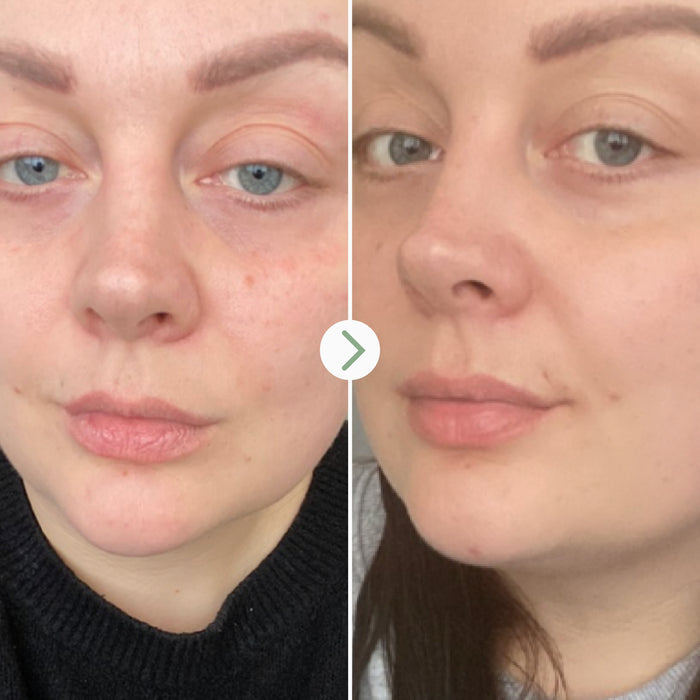 Pai Skincare-Rosehip Bioregenerate-Skincare-5060139722117_5-The Detox Market |