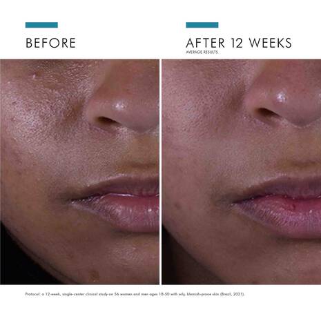 SkinCeuticals Silymarin CF 30ml