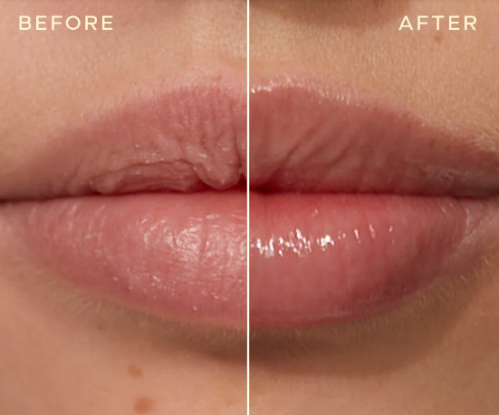[ Snowtox ]  Crystal Treatment Serum +  Lip Plumper